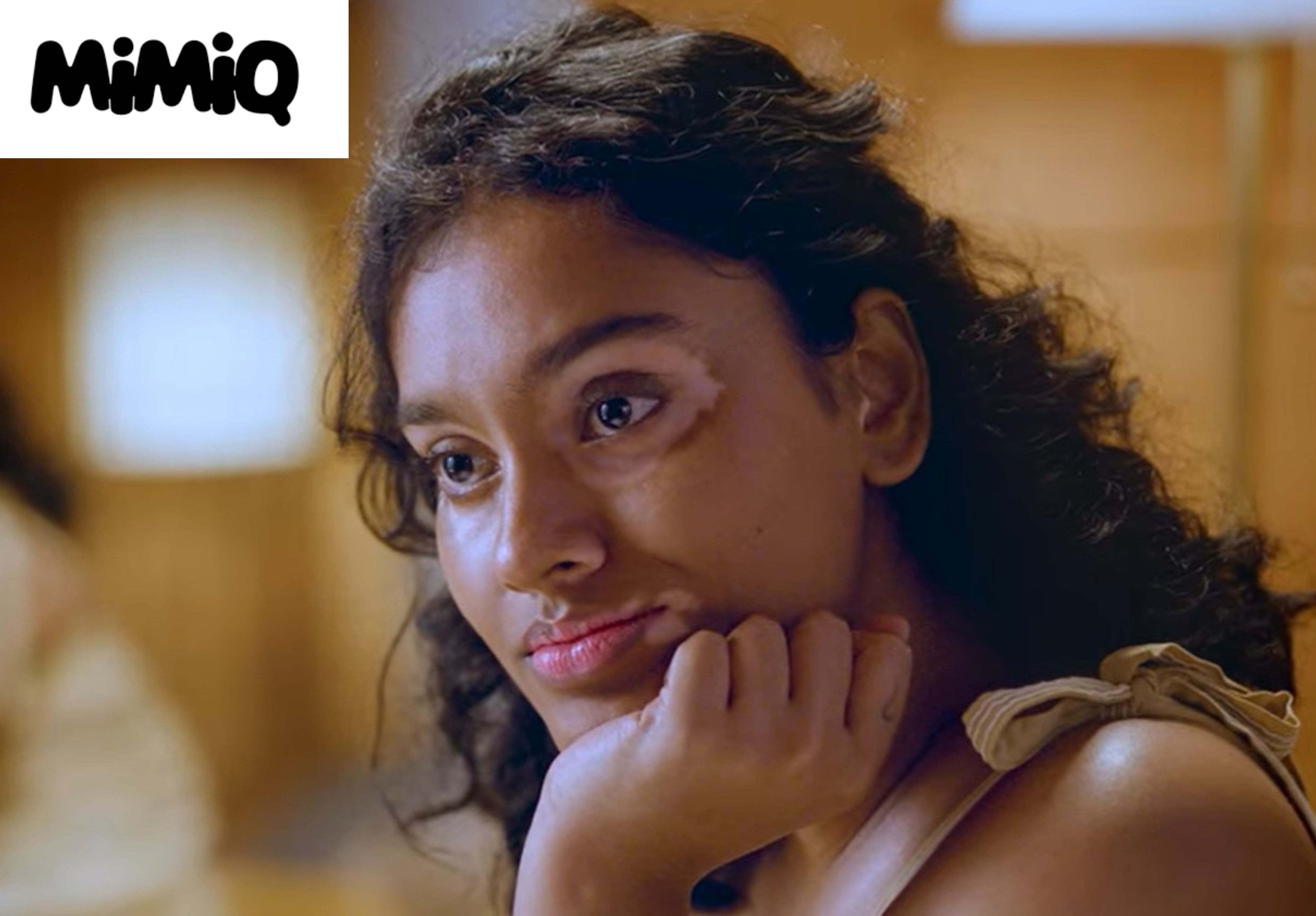 Mimiq launches in India with inclusive makeup for the vitiligo community, featuring the empowering “Gora Teeka” campaign on World Vitiligo Day Mimiq launches in India with inclusive makeup for the vitiligo community, featuring the empowering “Gora Teeka” campaign on World Vitiligo Day