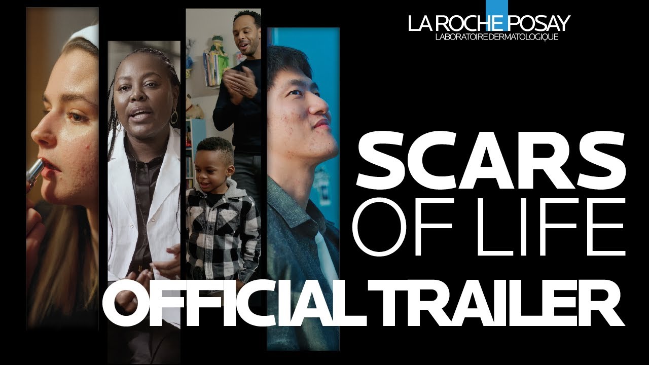 La Roche-Posay Unveils Powerful Documentary ‘Scars of Life’ La Roche-Posay Launches ‘Scars of Life’ Documentary — Redefining Skin Health and Emotional Healing