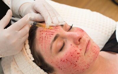 CDC Reports HIV Cases Linked to Unlicensed New Mexico Spa’s “Vampire Facials”