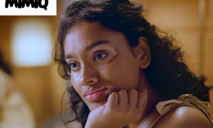 Mimiq redefines Beauty for the Vitiligo Community